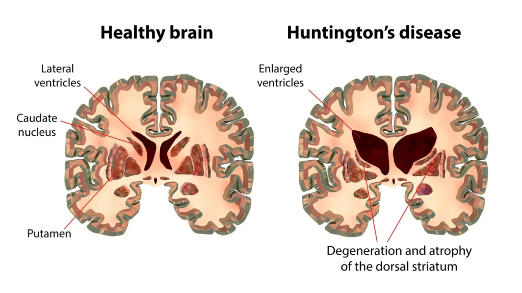 healthy brain